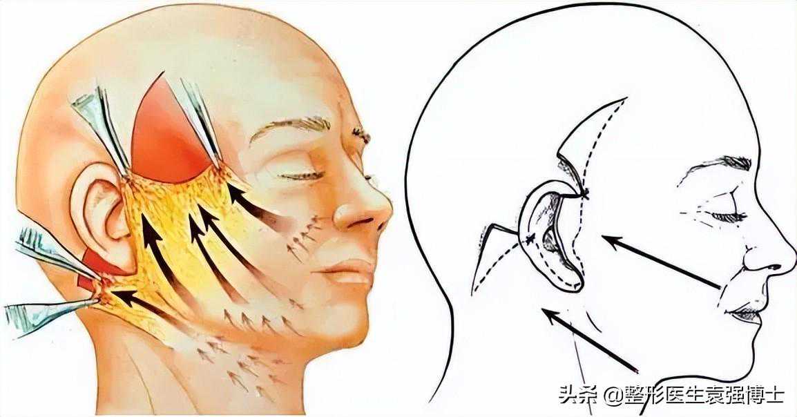 把拉皮做了，说几点你不知道的事，都是大实话