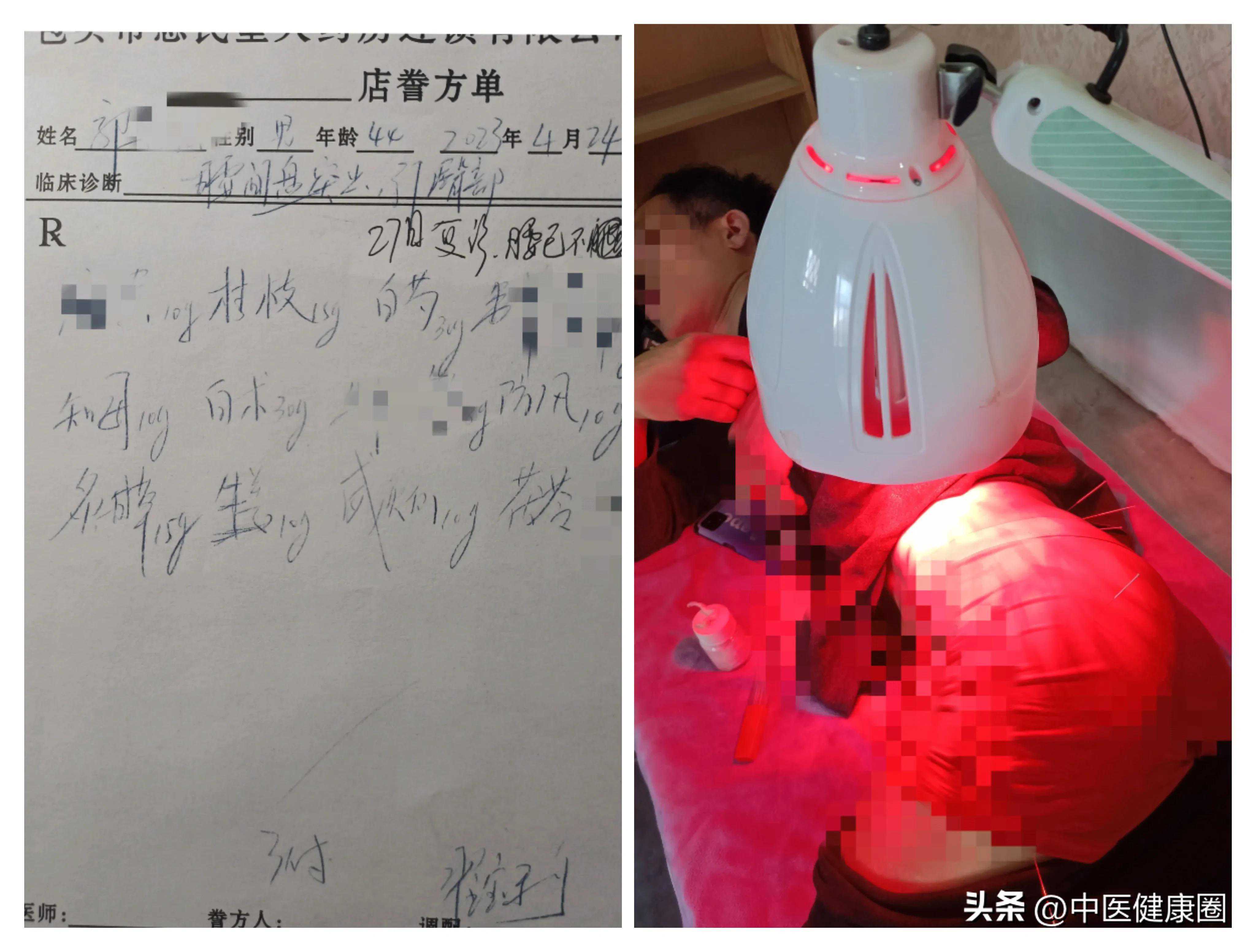 一张金匮要略方，巧治腰突有奇效，免手术了！